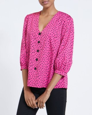 Button Front Top Button Front Top